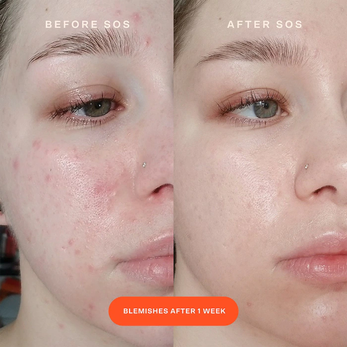 Lorem ipsum dolor sit amet nec etiamconsectetur. Egestas cursus a maecenas massa facilisi adipiscing dolor iaculis. In mattis nec morbi.